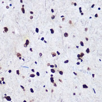 Przeciwciało anty-fosfo-Smad2-S465/467+ Smad3-S423/425 produkowane u królików