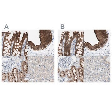 Anti-VIL1 antibody produced in rabbit Ab2, Prestige Antibodies&#174; Powered by Atlas Antibodies, affinity isolated antibody, buffered aqueous glycerol solution