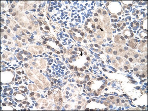 Anti-RORA (AB3) antibody produced in rabbit IgG fraction of antiserum