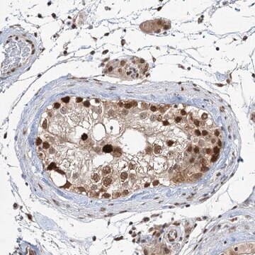 Anti-ZCCHC8 antibody produced in rabbit Prestige Antibodies&#174; Powered by Atlas Antibodies, affinity isolated antibody, buffered aqueous glycerol solution