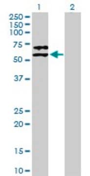 Anti-SERPINF2 antibody produced in mouse purified immunoglobulin, buffered aqueous solution