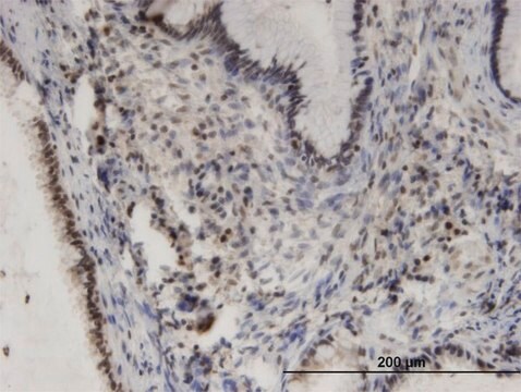 Monoclonal Anti-PHKA2 antibody produced in mouse clone 3H3, purified immunoglobulin, buffered aqueous solution