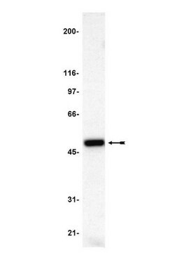 Przeciwciało anty-p47-phox serum, Upstate&#174;