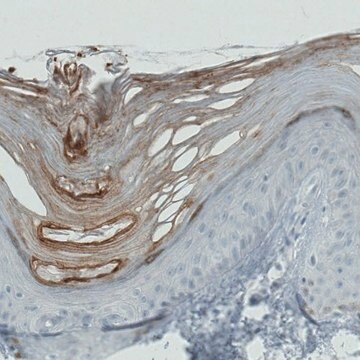 Monoclonal Anti-RNASE7 antibody produced in mouse Prestige Antibodies&#174; Powered by Atlas Antibodies, clone CL0223, purified immunoglobulin, buffered aqueous glycerol solution