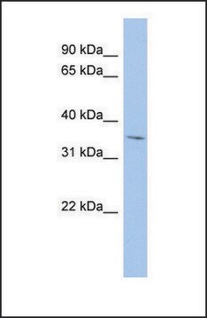 抗MPST抗体 ウサギ宿主抗体 affinity isolated antibody