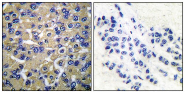 Anti-WNK1 antibody produced in rabbit affinity isolated antibody