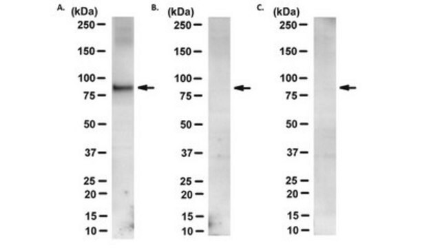 Anti-phospho-NHE3 (Ser605) Antibody, clone 10A8 clone 10A8, from mouse