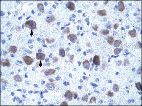 抗KCNIP4抗体 ウサギ宿主抗体 affinity isolated antibody