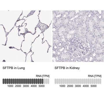 Anti-SFTPB antibody produced in rabbit Prestige Antibodies&#174; Powered by Atlas Antibodies, affinity isolated antibody, buffered aqueous glycerol solution