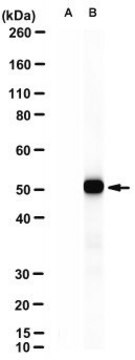 Anti-MLKL Antibody, clone 10C2