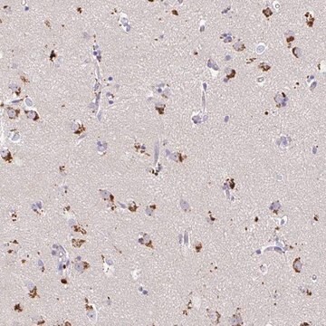 Anti-MAP1LC3A antibody produced in rabbit Prestige Antibodies&#174; Powered by Atlas Antibodies, affinity isolated antibody, buffered aqueous glycerol solution