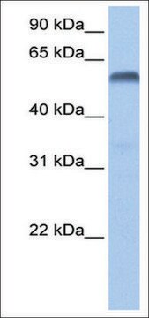 Anti-PAX3 antibody produced in rabbit affinity isolated antibody