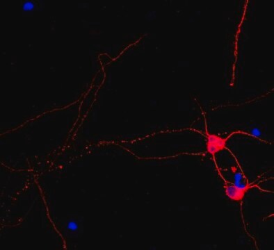 Anticorpo anti-Beta III tubulina, coniugato con Cy3 from rabbit, CY3 conjugate