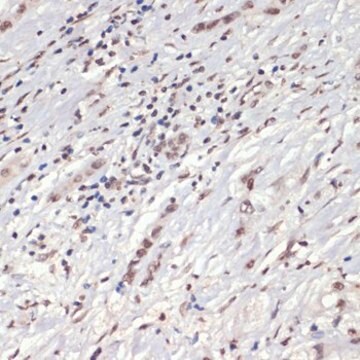 Anti-Phospho-Jak2-Y1007/1008 antibody produced in rabbit