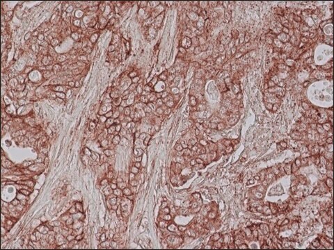 Anti-S100-A10 antibody produced in rabbit IgG fraction of antiserum, buffered aqueous solution