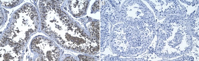 Anti-Rab14 Antibody, clone 1M15 ZooMAb&#174; Rabbit Monoclonal recombinant, expressed in HEK 293 cells