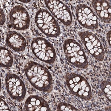 Anti-SDHAF2 antibody produced in rabbit Prestige Antibodies&#174; Powered by Atlas Antibodies, affinity isolated antibody, buffered aqueous glycerol solution