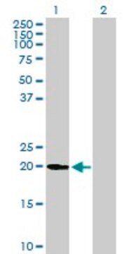 Anti-UFC1 antibody produced in mouse purified immunoglobulin, buffered aqueous solution