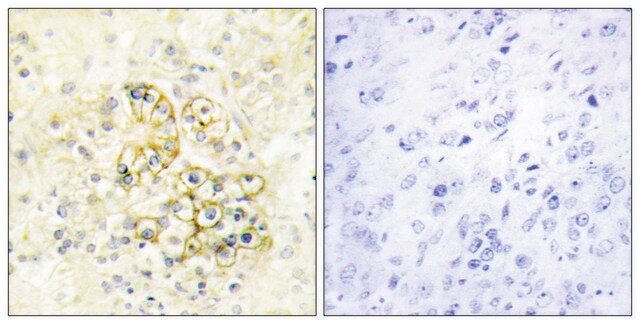 Anti-TMEPA antibody produced in rabbit affinity isolated antibody