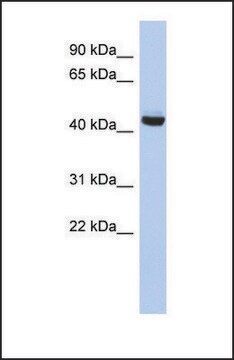 Anti-EXOC4, (N-terminal) antibody produced in rabbit affinity isolated antibody