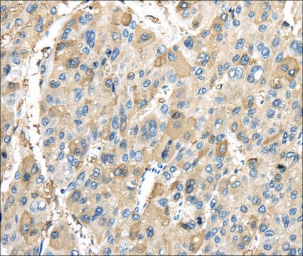 Anti-INHBB affinity isolated antibody