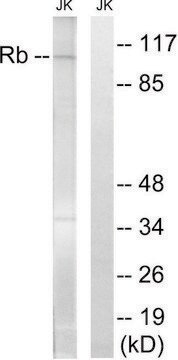 Anti-Retinoblastoma antibody produced in rabbit affinity isolated antibody