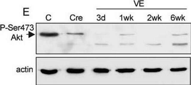 抗アクチン, N-末端 ウサギ宿主抗体 ~0.5&#160;mg/mL, affinity isolated antibody, buffered aqueous solution