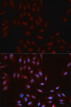 Anti-Phospho-p38 MAPK-Y322 antibody produced in rabbit