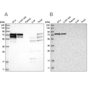 Anti-PPP2R5D antibody produced in rabbit Prestige Antibodies&#174; Powered by Atlas Antibodies, affinity isolated antibody, buffered aqueous glycerol solution, ab1