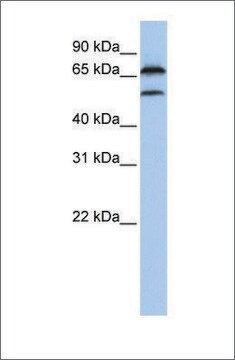 Anti-FBXO7 antibody produced in rabbit affinity isolated antibody