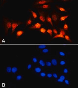 Anti-XPB antibody produced in rabbit ~1&#160;mg/mL, affinity isolated antibody, buffered aqueous solution