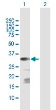 Anti-CSGALNACT1 antibody produced in rabbit purified immunoglobulin, buffered aqueous solution