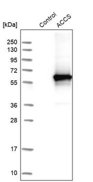 Anti-ACCS antibody produced in rabbit Prestige Antibodies&#174; Powered by Atlas Antibodies, affinity isolated antibody, buffered aqueous glycerol solution, Ab2