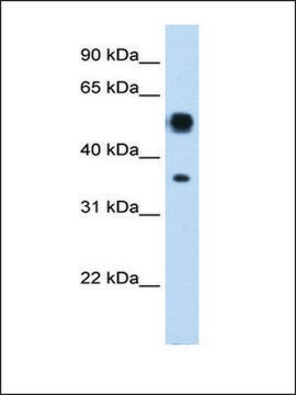 Anti-ASL (AB1) antibody produced in rabbit affinity isolated antibody