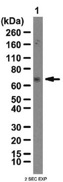 Anti-IGF2-mRNA-Bindungsprotein 3-Antikörper from rabbit, purified by affinity chromatography