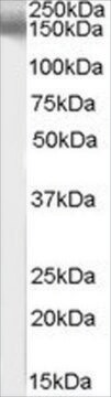 Anti-EPB41L3/DAL1 antibody produced in goat affinity isolated antibody, buffered aqueous solution