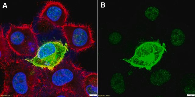 Anti-His tag Antibody, clone 1J13 ZooMAb&#174; Rabbit Monoclonal recombinant, expressed in HEK 293 cells