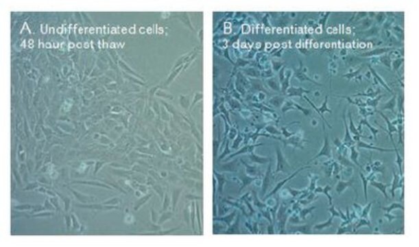 N27ラットドーパミン作動性神経細胞株 The N27 rat dopaminergic neural cell line has been used as a dopaminergic neuron model for in vitro and in vivo studies.