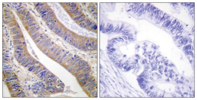 Anti-p47 PHOX antibody produced in rabbit affinity isolated antibody