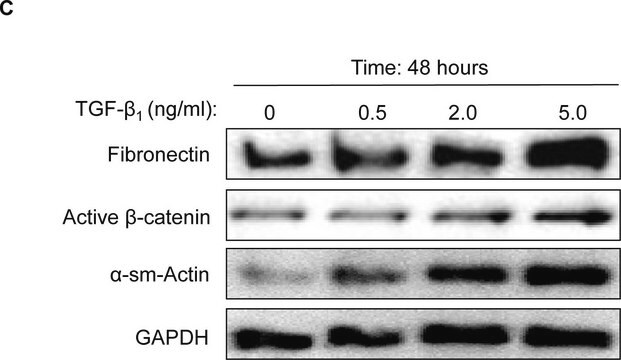 Anticorpo anti-&#946;-catenina ativa (anti-ABC), clone 8E7 clone 8E7, Upstate&#174;, from mouse