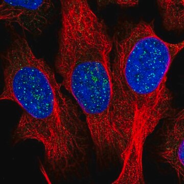 Anty-TERF1 Prestige Antibodies&#174; Powered by Atlas Antibodies, affinity isolated antibody