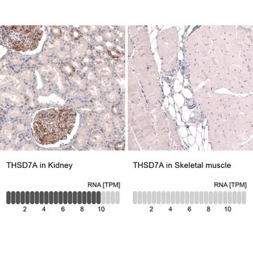 Monoclonal Anti-THSD7A antibody produced in mouse Prestige Antibodies&#174; Powered by Atlas Antibodies, clone CL3779, purified immunoglobulin, buffered aqueous glycerol solution