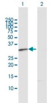 Anti-RDH12 antibody produced in rabbit purified immunoglobulin, buffered aqueous solution