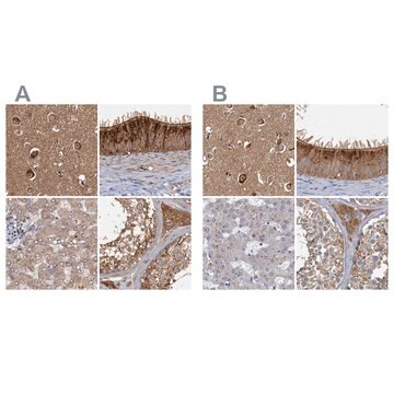 Anti-TOLLIP antibody produced in rabbit Prestige Antibodies&#174; Powered by Atlas Antibodies, affinity isolated antibody, buffered aqueous glycerol solution