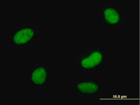 Anti-SMARCAL1 antibody produced in mouse purified immunoglobulin, buffered aqueous solution