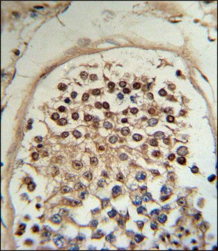 ANTI-HCCA2 (N-TERM) antibody produced in rabbit IgG fraction of antiserum, buffered aqueous solution