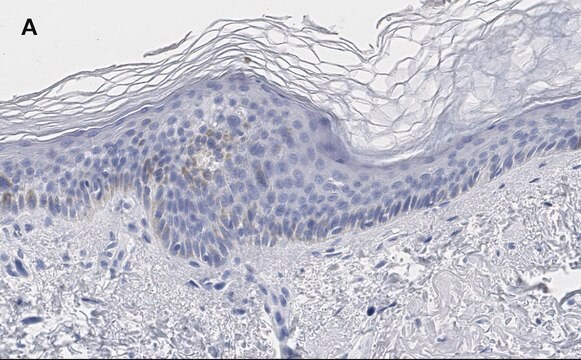 抗リン酸化AMPK&#945; (Thr172)抗体 クローン5J23 ZooMAb&#174; ウサギ・モノクローナル recombinant, expressed in HEK 293 cells