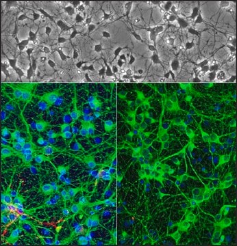 Rat Hippocampal Neurons: RHiN