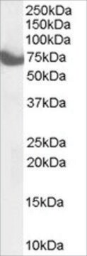 Anti-HIP14/ZDHHC17 antibody produced in goat affinity isolated antibody, buffered aqueous solution