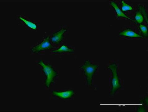 抗PRKAG2抗体 ウサギ宿主抗体 purified immunoglobulin, buffered aqueous solution